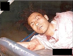 CIA Abu Zubaydah Interrogation Photo. 